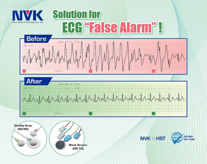 Solution for reducing ECG false alarm and alarm fatigue